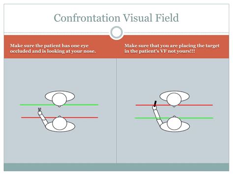 CONFRONTATION VISUAL FIELDS .
